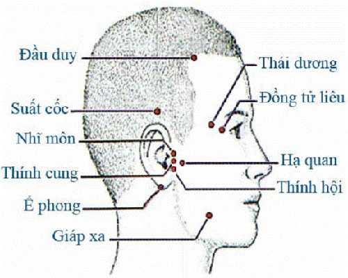 HUYỆT VÙNG ĐẦU (MẶT BÊN) Tranh châm cứu do bộ y tế ban hành